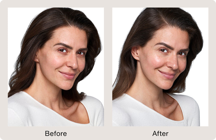 SkinVive™ by Juvederm®