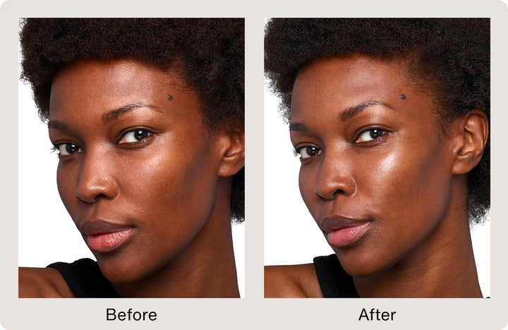 SkinVive™ by Juvederm®