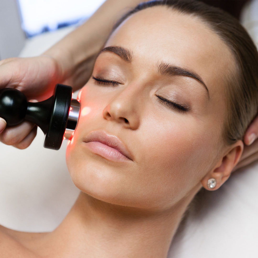 IPL Photofacial - Full Face OR Neck & Chest